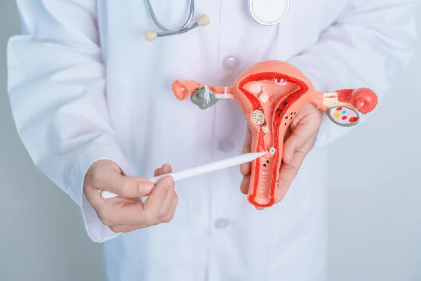 Myomectomy