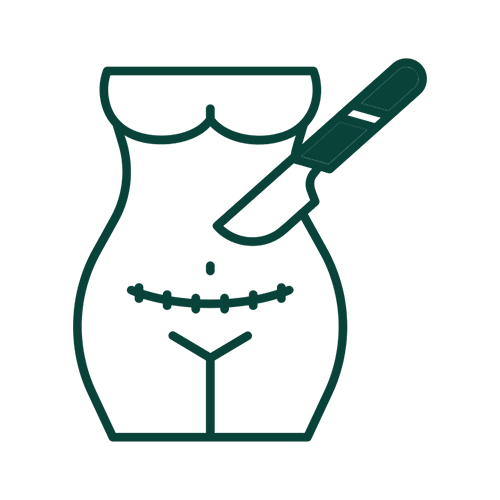 Cesarean Surgery+